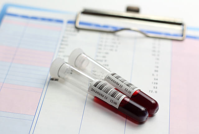 血液検査